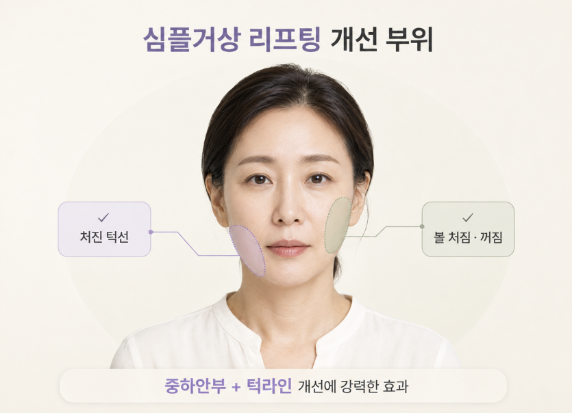 simple-facelift-treatment-areas-column-variant.png