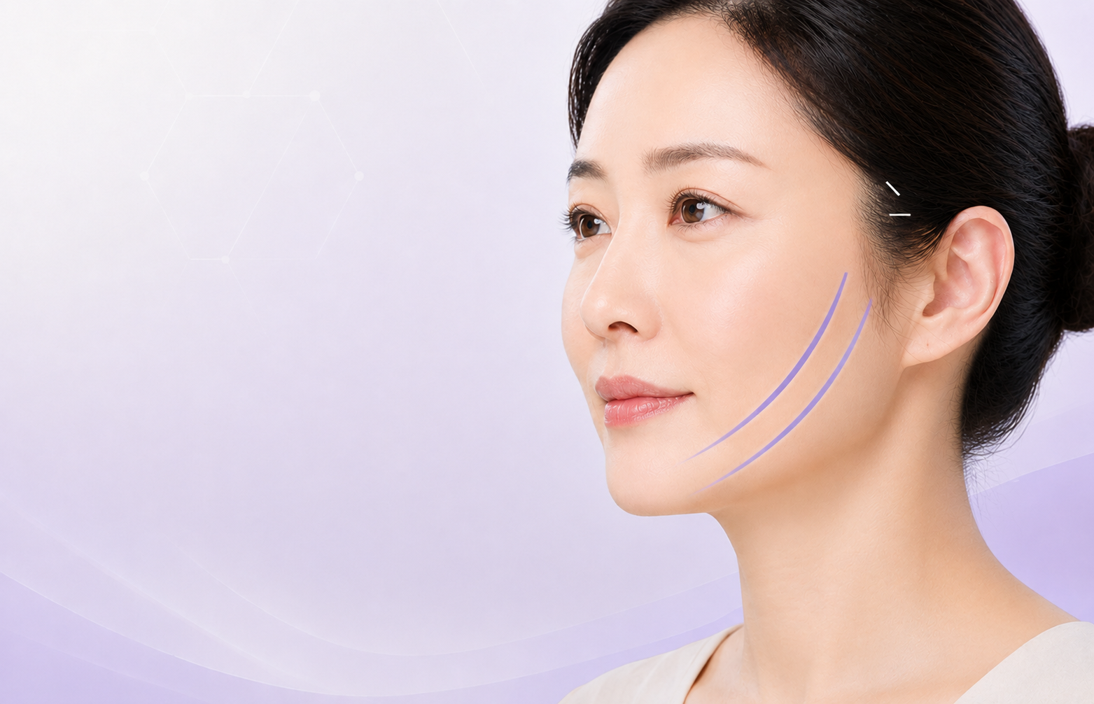 엘팅1리프팅, 작은 절개로 어떤 처짐까지 개선할 수 있을까요?