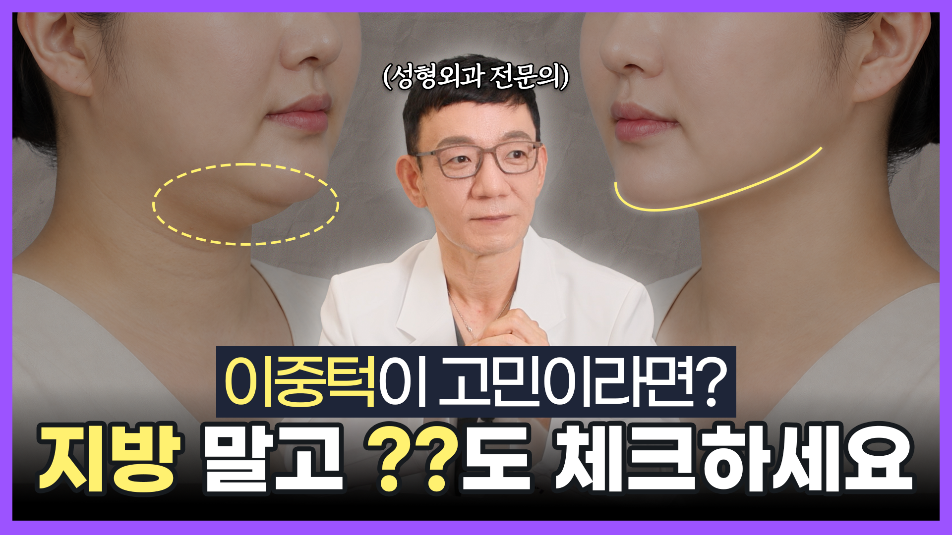 유튜브 썸네일 1