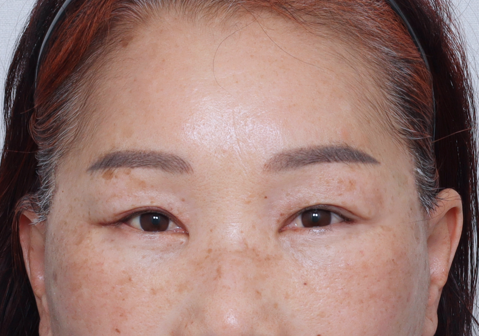 upper_01_after