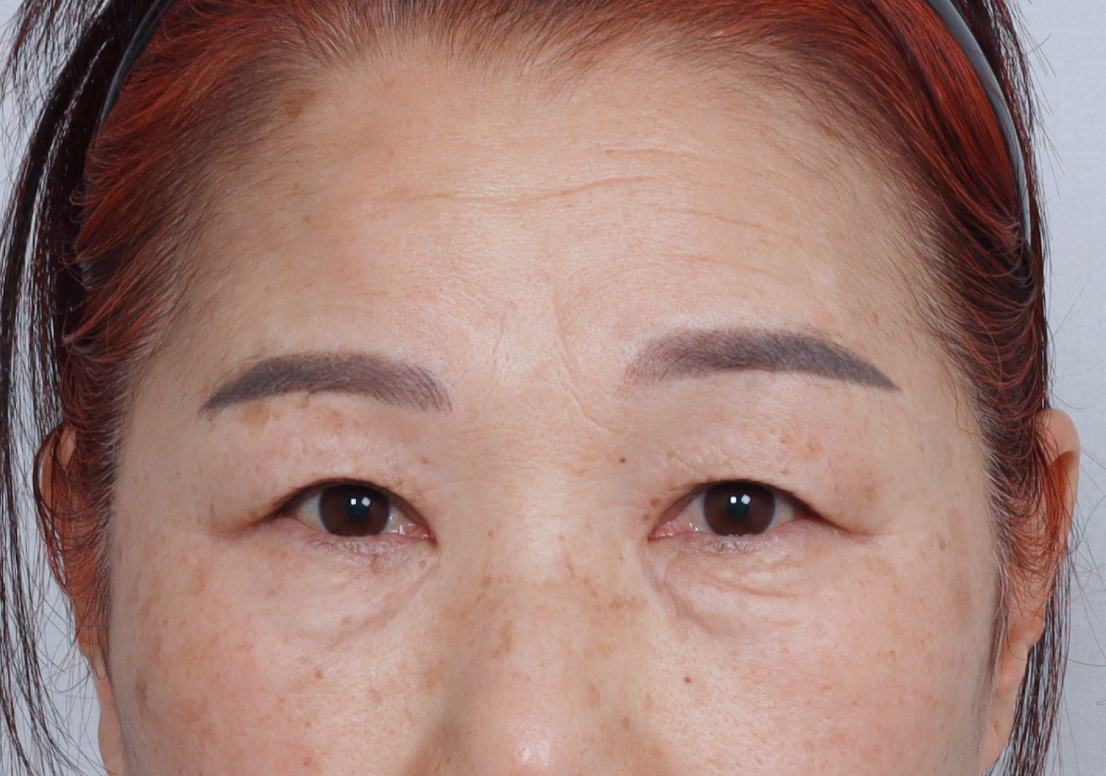 upper_01_before