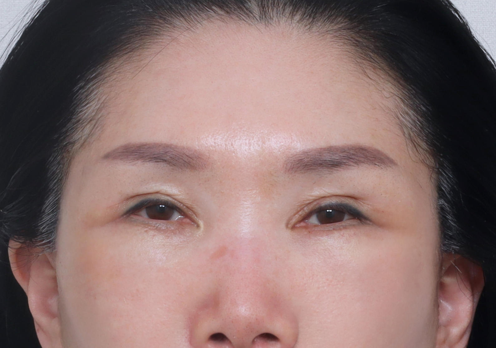 upper_02_after