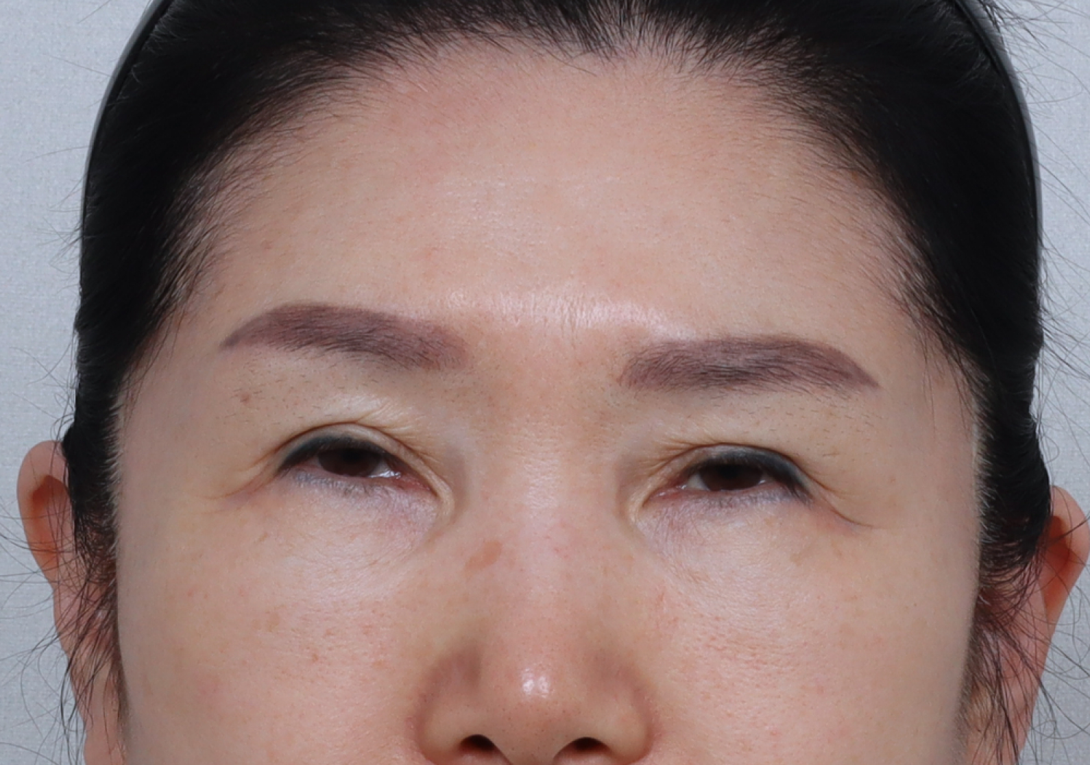 upper_02_before