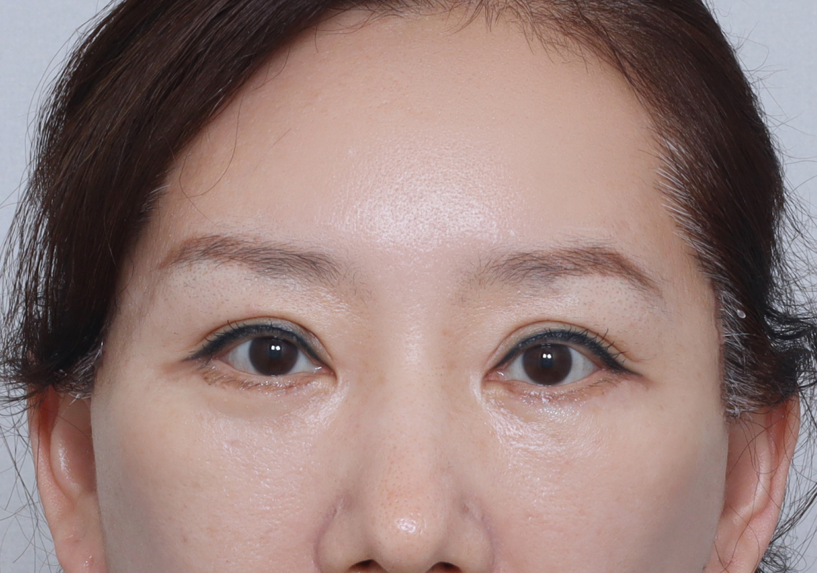 upper_03_after