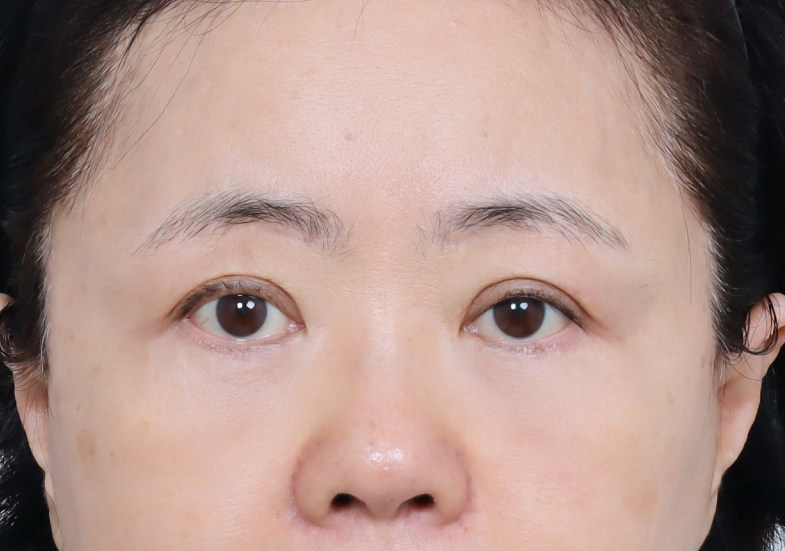 upper_04_after