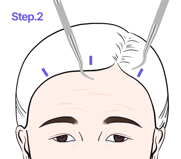 step02