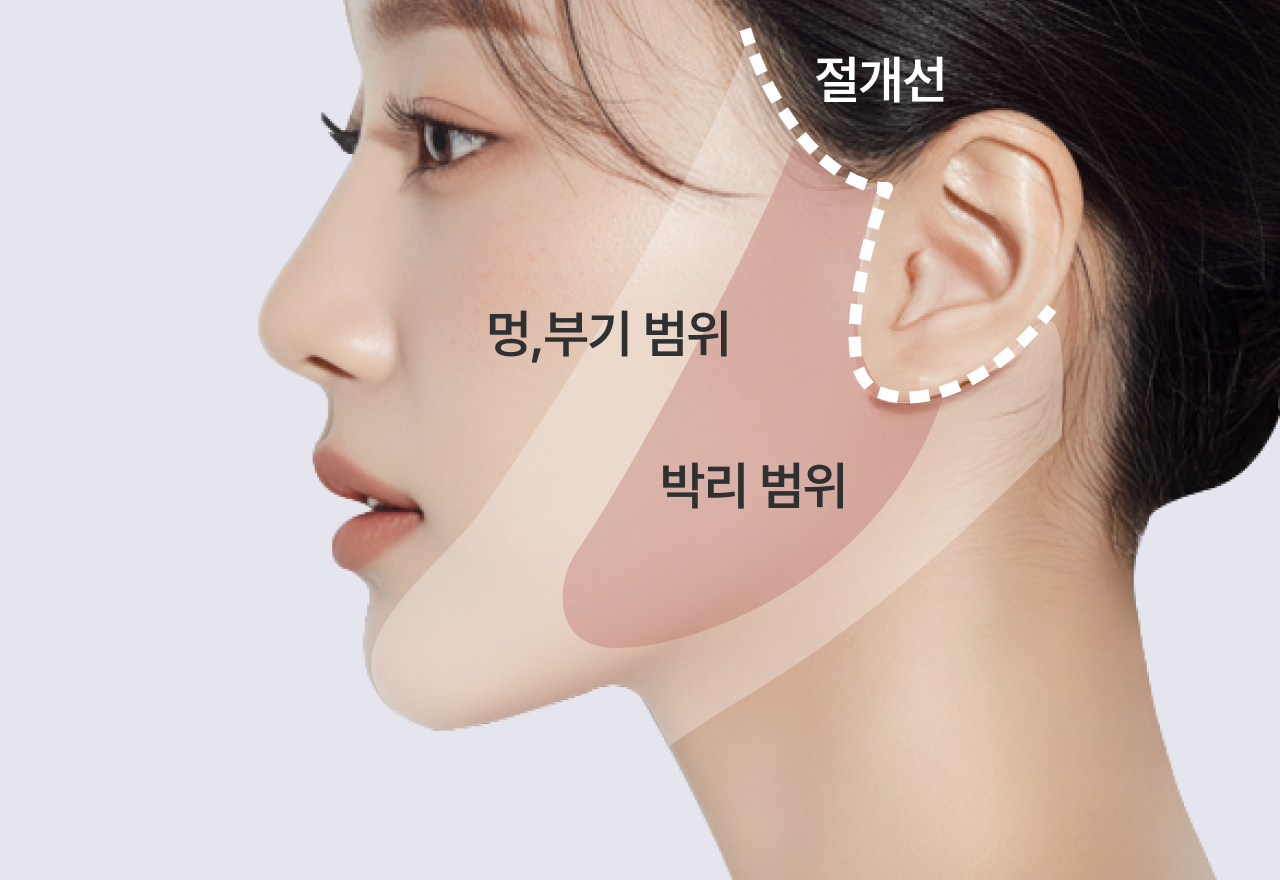 case 01