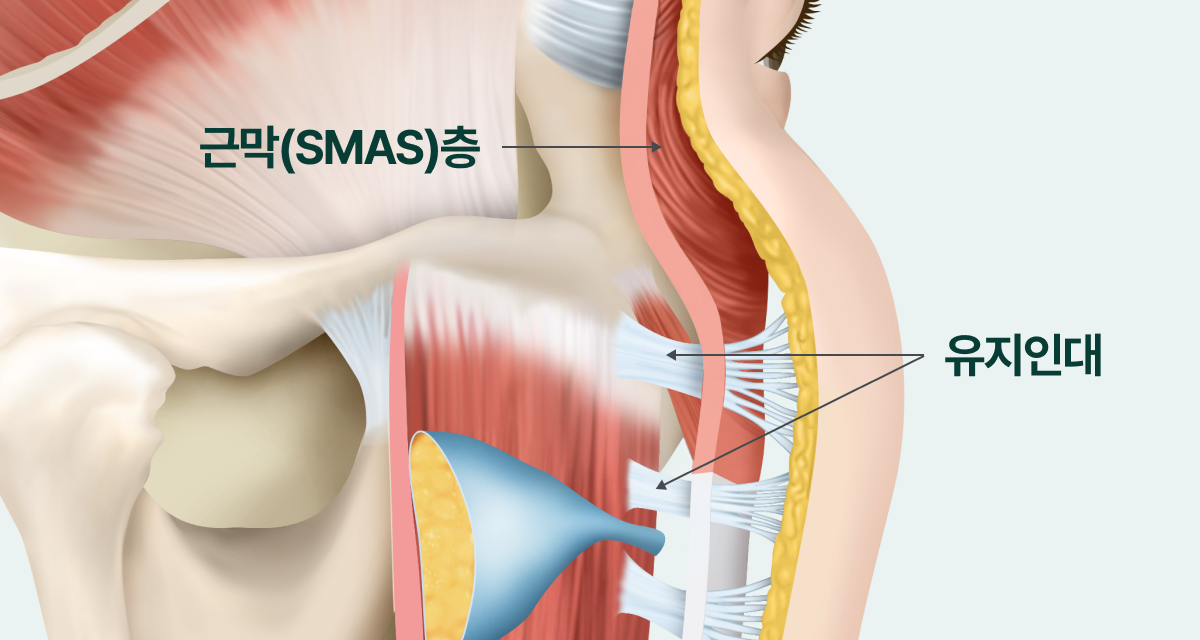 안면피부, 피하지방층, 근막(SMAS)층을 이어주는 유지인대