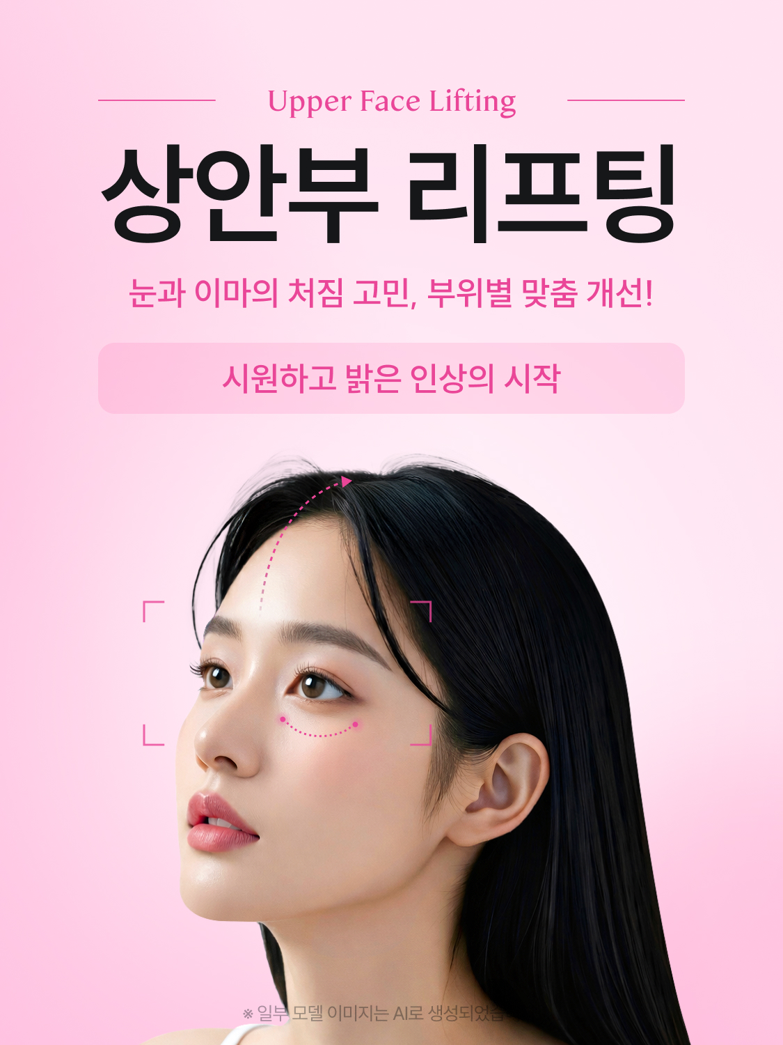 상안부 리프팅