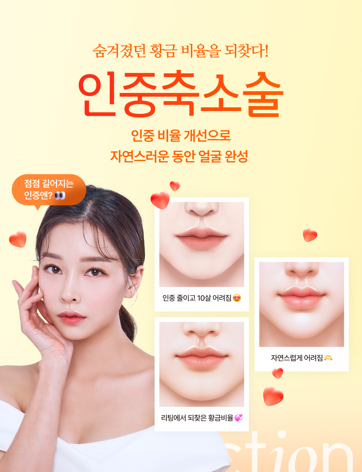 숨겨졌던 황금 비율을 되찾다! 인중축소술 - 인중 비율 개선으로 자연스러운 동안 얼굴 완성