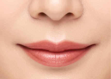 립스마일 리프팅 1단계