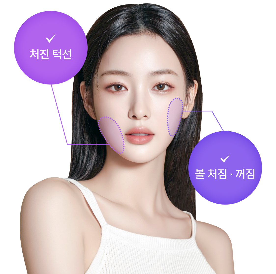 심플거상 리프팅 개선부위