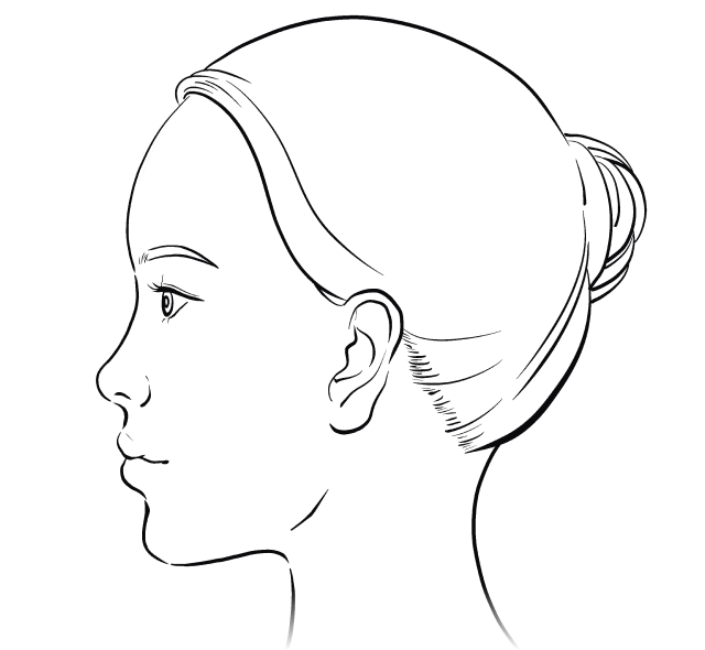 심플거상 리프팅이란?