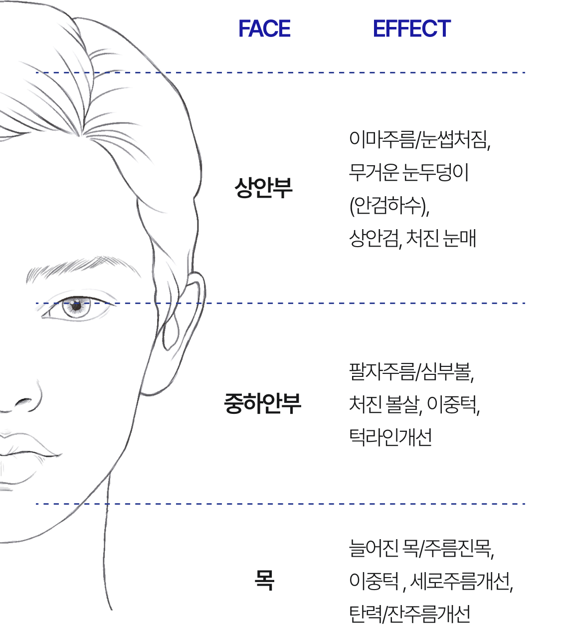 상안부 : 이마주름/눈썹처짐, 무거운 눈두덩이(안검하수), 상안검, 처진 눈매 / 중하안부 : 팔자주름&심부볼, 처진 볼살, 이중턱, 턱라인개선 / 목 : 늘어진 목&주름진 목, 이중턱, 세로주름개선, 탄력&잔주름개선