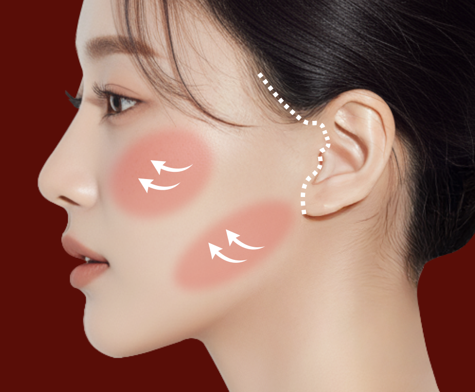 스마일거상 or 퍼펙트거상