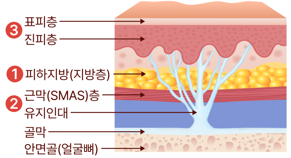 리팅만의 연부 조직 다루기 노하우