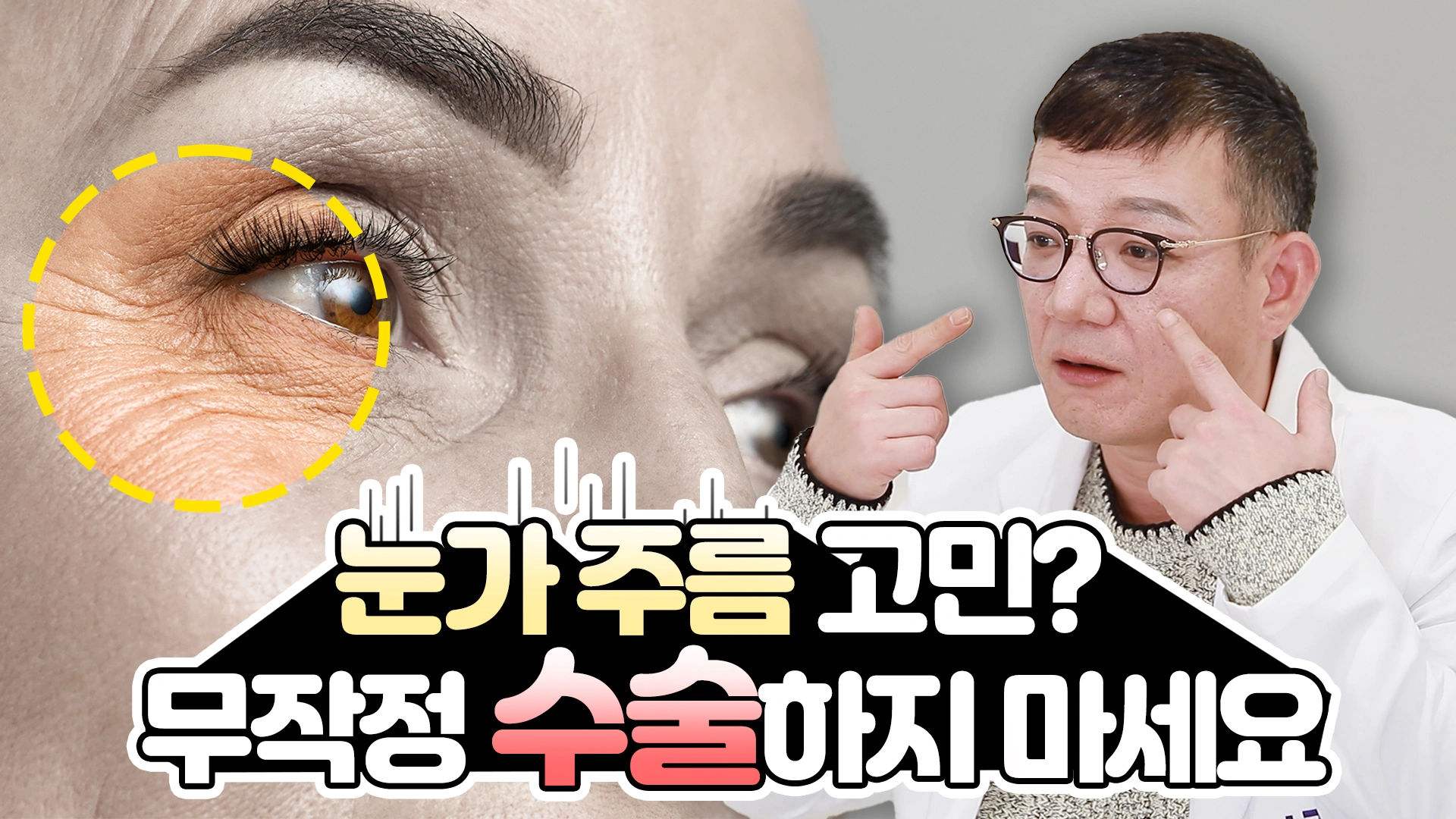 눈가 주름 고민? 무작정 수술하지 마세요