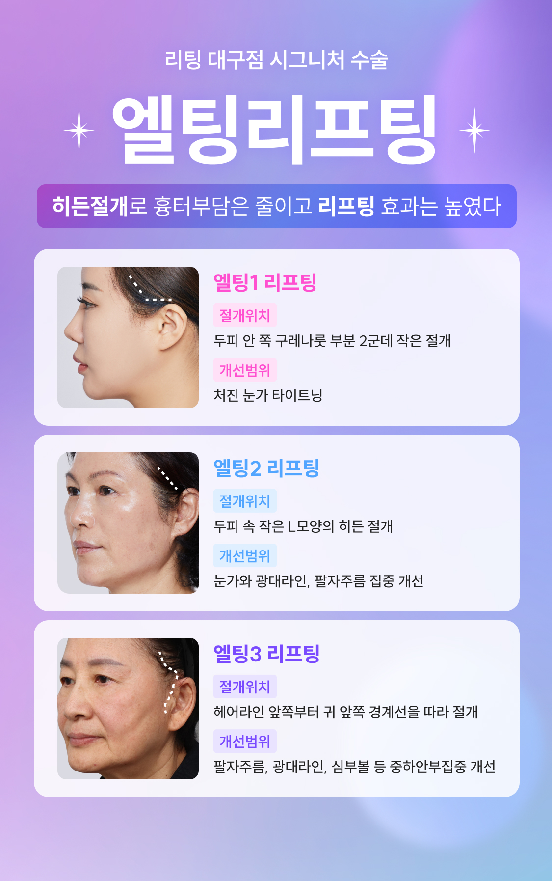 통증은 적고, 더 강력한 세르프 리프팅