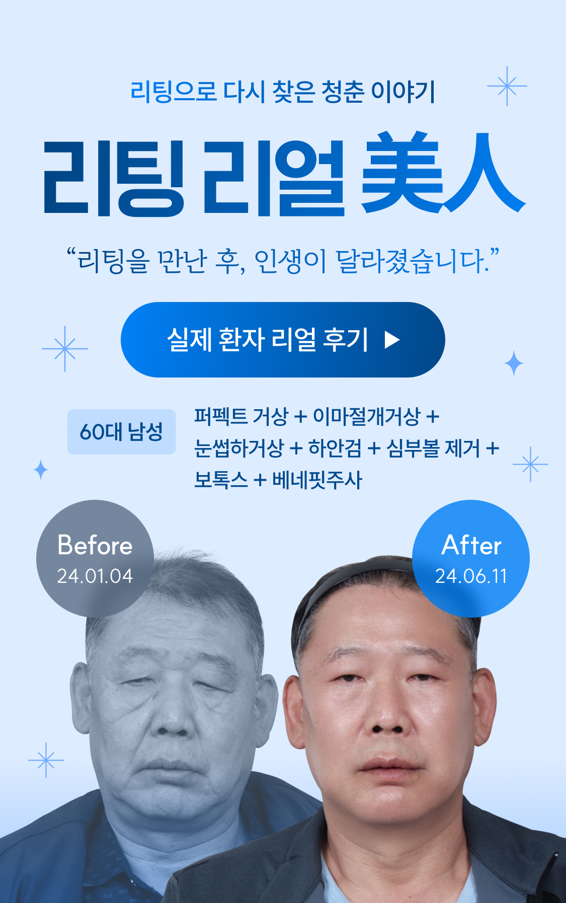 리팅으로 다시 찾은 청춘 이야기 리팅 리얼 美人
