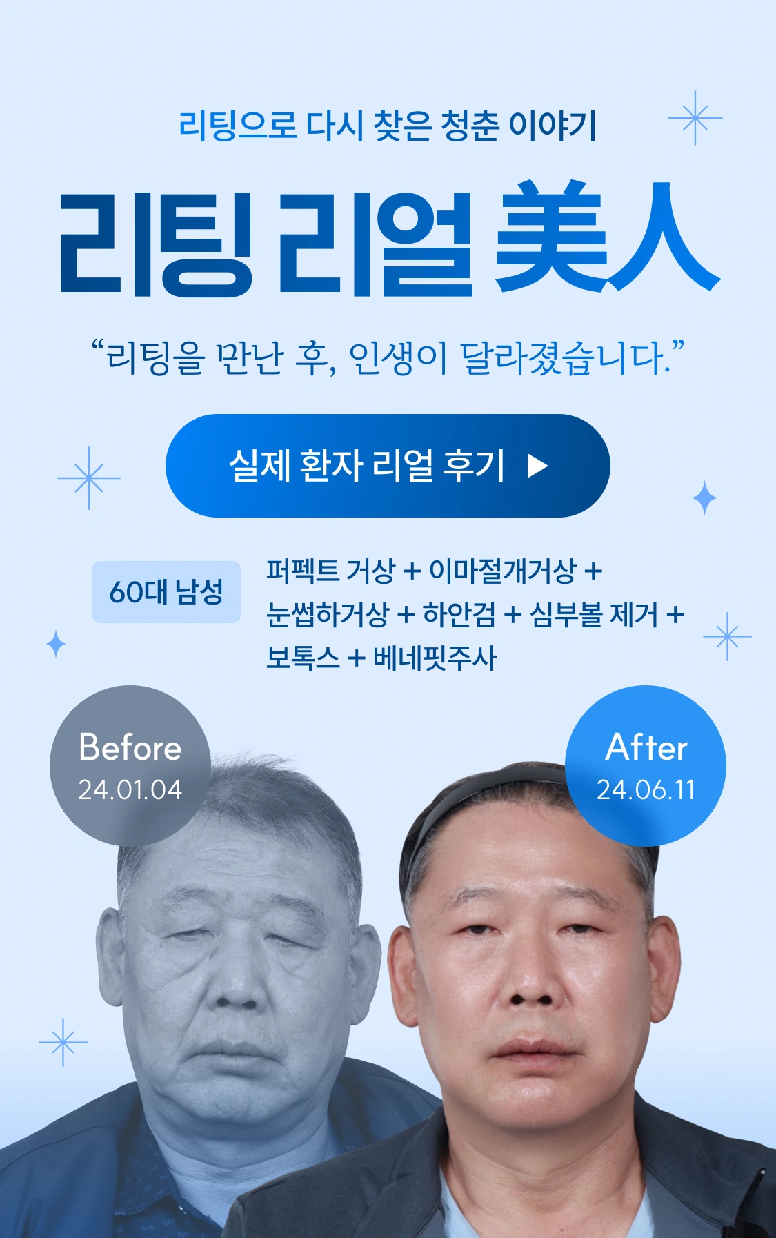 리팅으로 다시 찾은 청춘 이야기 리팅 리얼 美人