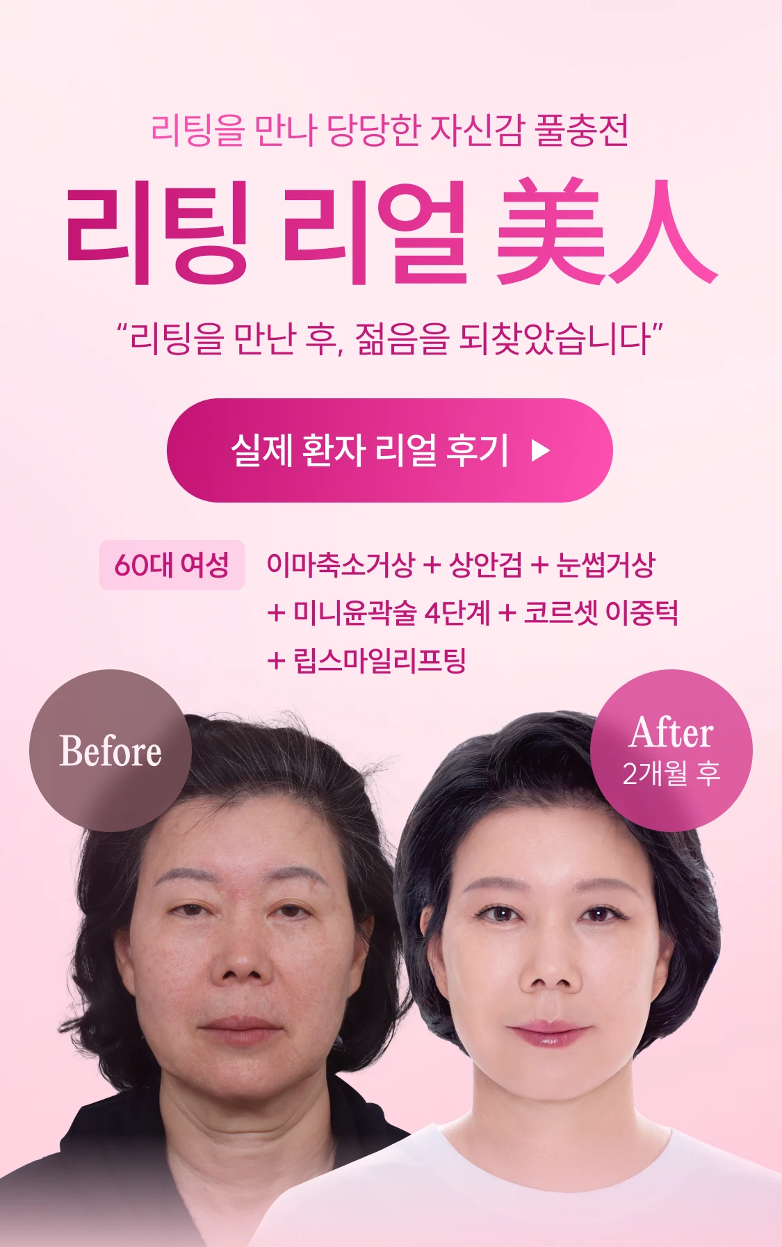 리팅을 만나 당당한 자신감 풀충전 리팅 리얼 美人