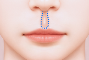 입술이 평평하거나 생기 없어 보이는 경우 예시